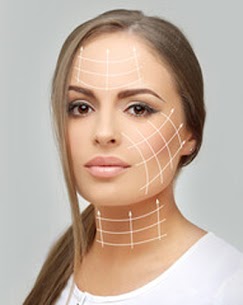 Trilift - non-surgical facelift